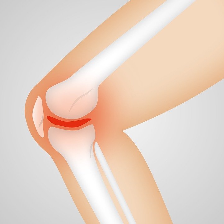 Ejercicios para aliviar el dolor de rodilla y fortalecer los músculos
